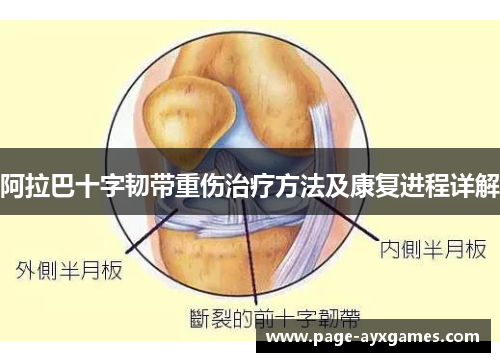 阿拉巴十字韧带重伤治疗方法及康复进程详解 阿拉巴十字韧带重伤治疗方法及康复进程详解